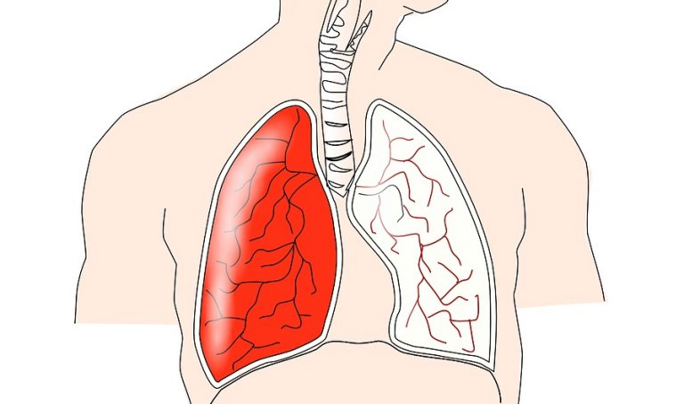 Top 10 địa chỉ khám phổi tốt ở Hà Nội bạn nên biết