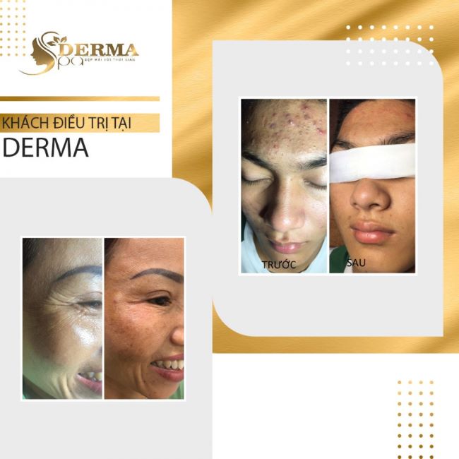 Derma Spa chưa bao giờ khiến chị em phải hối hận khi chọn đây là nơi để bảo vệ và nâng niu vẻ đẹp của mình | Nguồn: Derma Spa