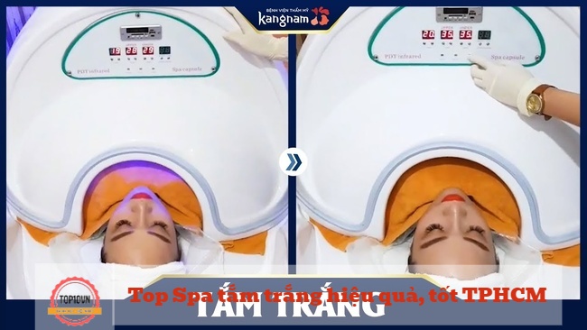 Bệnh viện thẩm mỹ Kangnam sở hữu nhiều ưu điểm như cơ sở vật chất, đội ngũ nhân viên hiện đại, chi phí điều trị thấp | Nguồn: Bệnh viện thẩm mỹ Kangnam