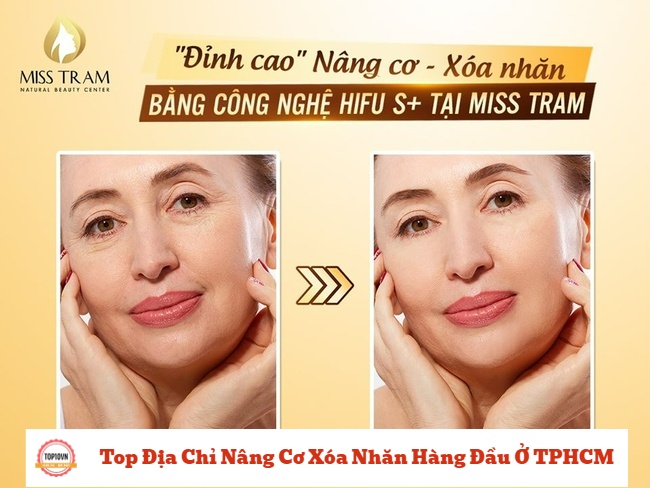 Công nghệ Hifu S + của Miss Tram là “phép màu” cho những phụ nữ ngoài 25 có làn da ngày càng chảy xệ | Nguồn: Miss Tram